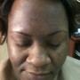 Scalp Treatment