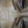 Age Smart Resurfacing peel