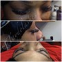 lash removal