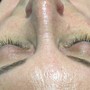 Eyelash Perm