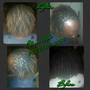 Scalp Treatment