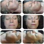 Neveskin Tightening Facial