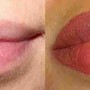 Lip Conditioning Treatment