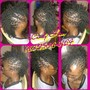 Scalp Treatment