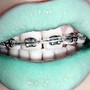 Couples Whitening