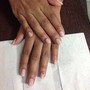 Gel removals