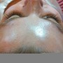 Whole face waxing