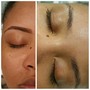 Eyelash Extension Removal