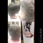 Scalp Treatment