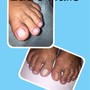 Foot Paraffin treatment