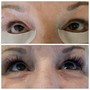 Lash Removal