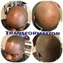 Fiber Enhancement/Hairline Only