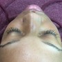 Brow Enhancement