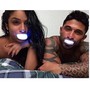 Couples Whitening