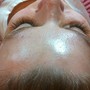 Whole face waxing