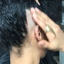 Scalp Treatment