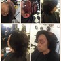 Hair growth treatment