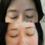 brow threading