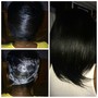 Scalp Treatment