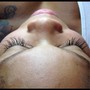 Lash removal