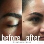 Teen Facial/Acne/Deep Pore Cleanse