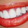 Professional Teeth Whitening Training