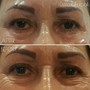 Eyelash Lift