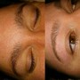 Oxygen facial