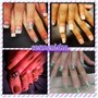 Nail Repair