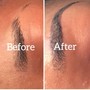 Steaming Hair Growth Treatment