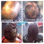 Hair Loss Cover Up w/ Closure