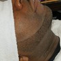 Facial Trim