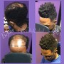 Hair Restoration