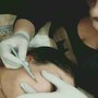 Dermaplaning add