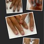 Nail Repair