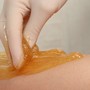 Arm Sugaring