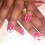 Shape nail