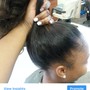 Scalp Treatment