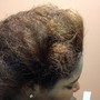 Dry and Itchy Scalp Treatment