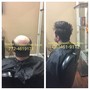 Hair loss Systems