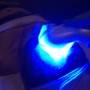 LED facial