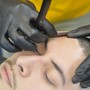 Facial Trim