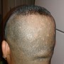 Add Scalp Treatment