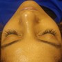 lash removal