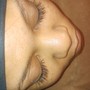 lash removal