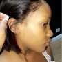 Scalp Treatment