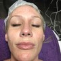 Dermaplaning add-on to Facial