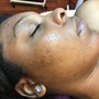 Dermaplaning add-on to Facial