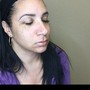 Microdermabrasion Treatment