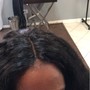 Scalp Treatment